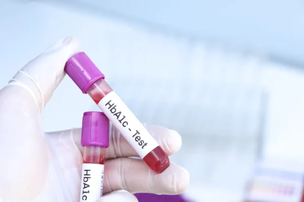 Eprubete cu sânge pentru test HbA1c
