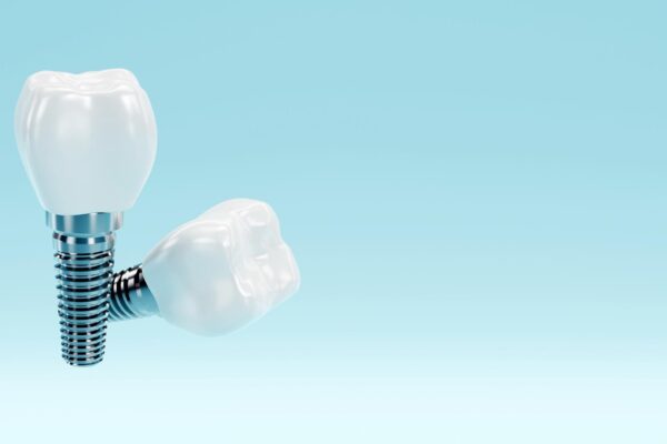 Cât durează vindecarea după un implant dentar