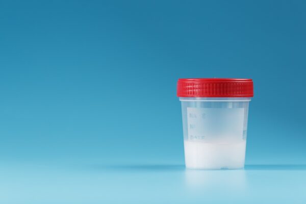 Spermograma: cum te pregătești conform instrucțiunilor laboratorului