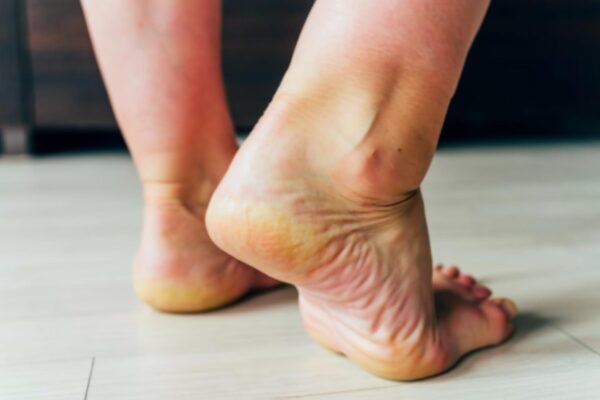Edeme apărute după începerea unui medicament: ce informații transmiți medicului