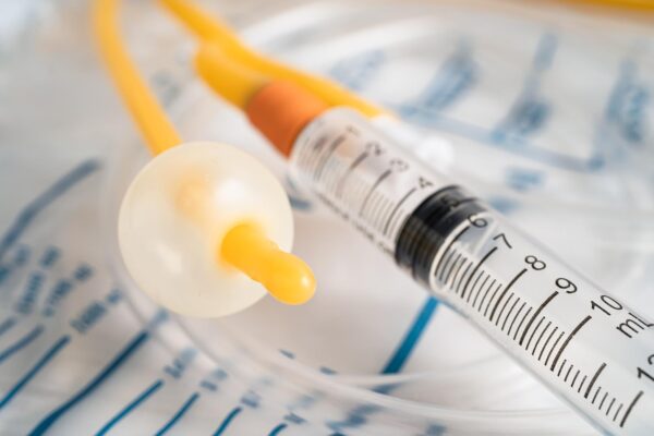Sonda nu mai drenează urină: când contactezi rapid echipa medicală