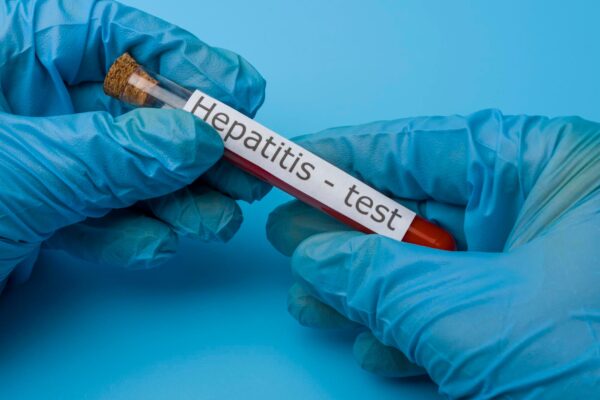 Hepatita C: de ce un test de anticorpi pozitiv necesită clarificare
