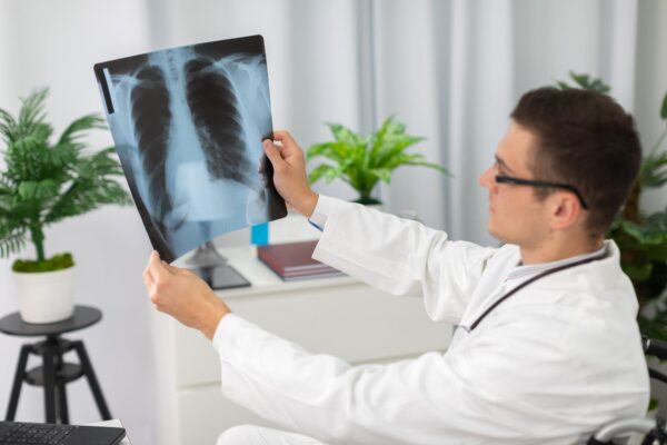 Nodul pulmonar găsit întâmplător: cum se stabilește urmărirea