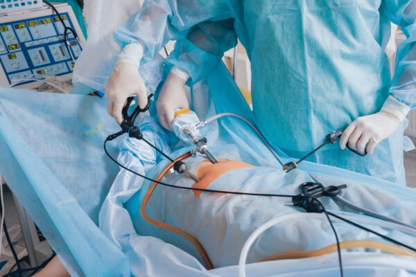 Colecistectomia: ce presupune operația de îndepărtare a vezicii biliare